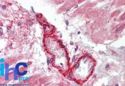 Immunohistochemistry-Paraffin: Flightless I Antibody [NBP2-24584] - Formalin-fixed, paraffin-embedded human heart probed with FLII antibody at 5 ug/ml.    Staining of formalin-fixed tissues is enhanced by boiling tissue sections in 10 mM sodium citrate buffer, pH 6.0 for 10-20 min followed by cooling at RT for 20 min.