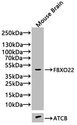 Western blot. All lanes: FBXO22 antibody at 1.98µg/ml. Lane 1: Mouse heart tissue. Lane 2: Hela whole cell lysate. Lane 3: MCF-7 whole cell lysate. Lane 4: HepG2 whole cell lysate. Secondary. Goat polyclonal to rabbit IgG at 1/10000 dilution. Predicted band size: 45, 5, 31 kDa. Observed band size: 45 kDa