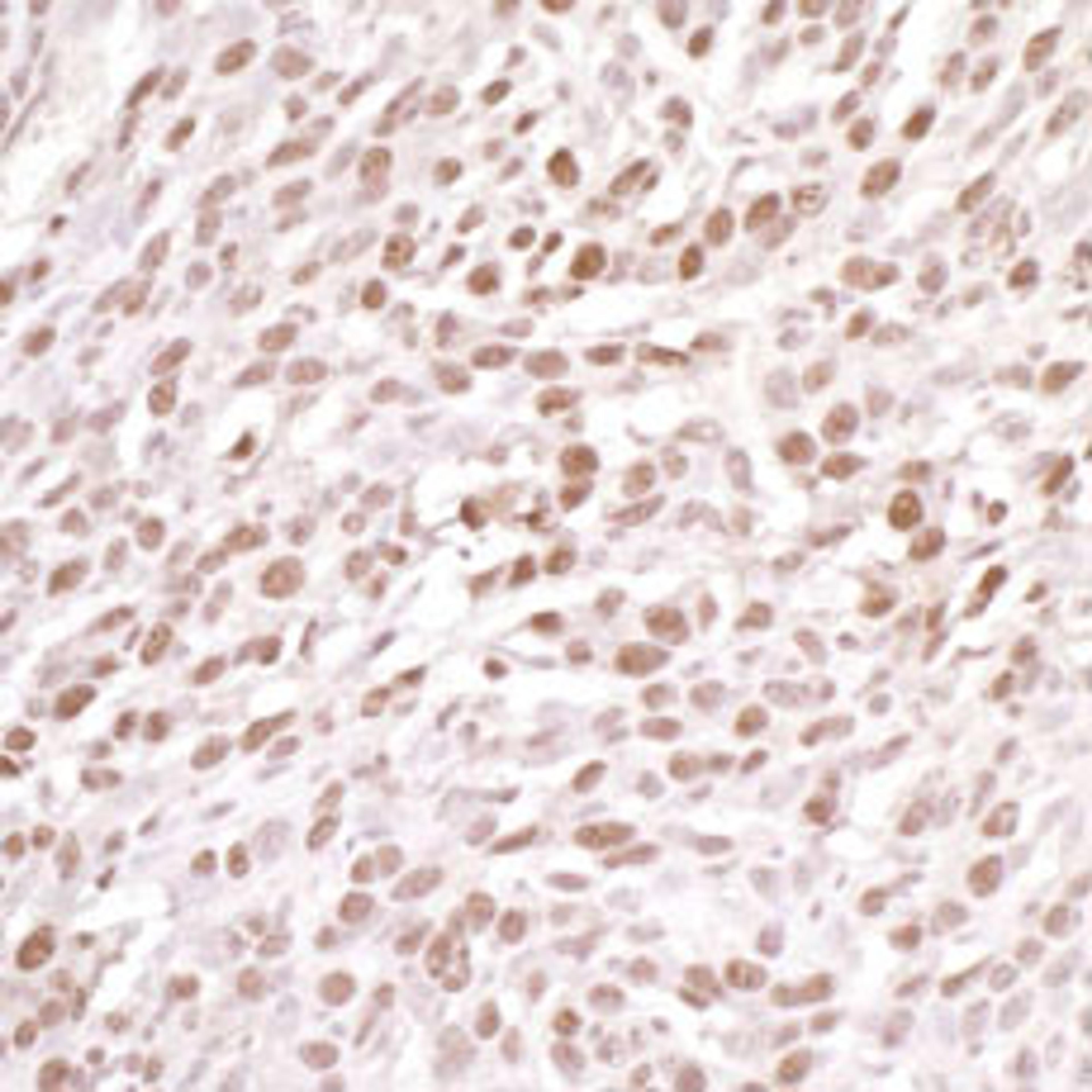 Detection of mouse DDB1 by immunohistochemistry.