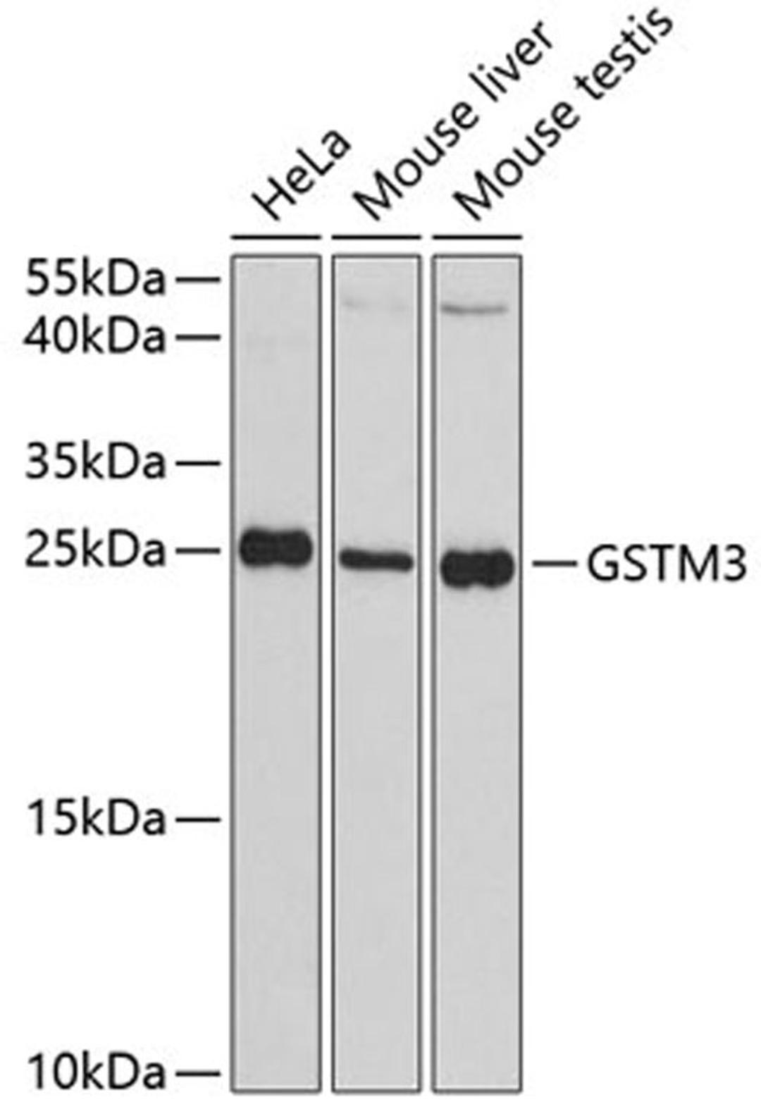 Western blot - GSTM3 antibody (A3905)