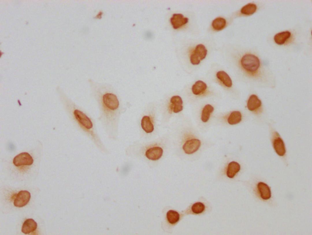 Immunocytochemistry analysis of CSB-PA010389PA09acHU diluted at 1:10 and staining in Hela cells(treated with 30mM sodium butyrate for 4h) performed on a Leica BondTM system. The cells were fixed in 4% formaldehyde, permeabilized using 0.2% Triton X-100 and blocked with 10% normal goat serum 30min at RT. Then primary antibody (1% BSA) was incubated at 4°C overnight. The primary is detected by a biotinylated secondary antibody and visualized using an HRP conjugated SP system.