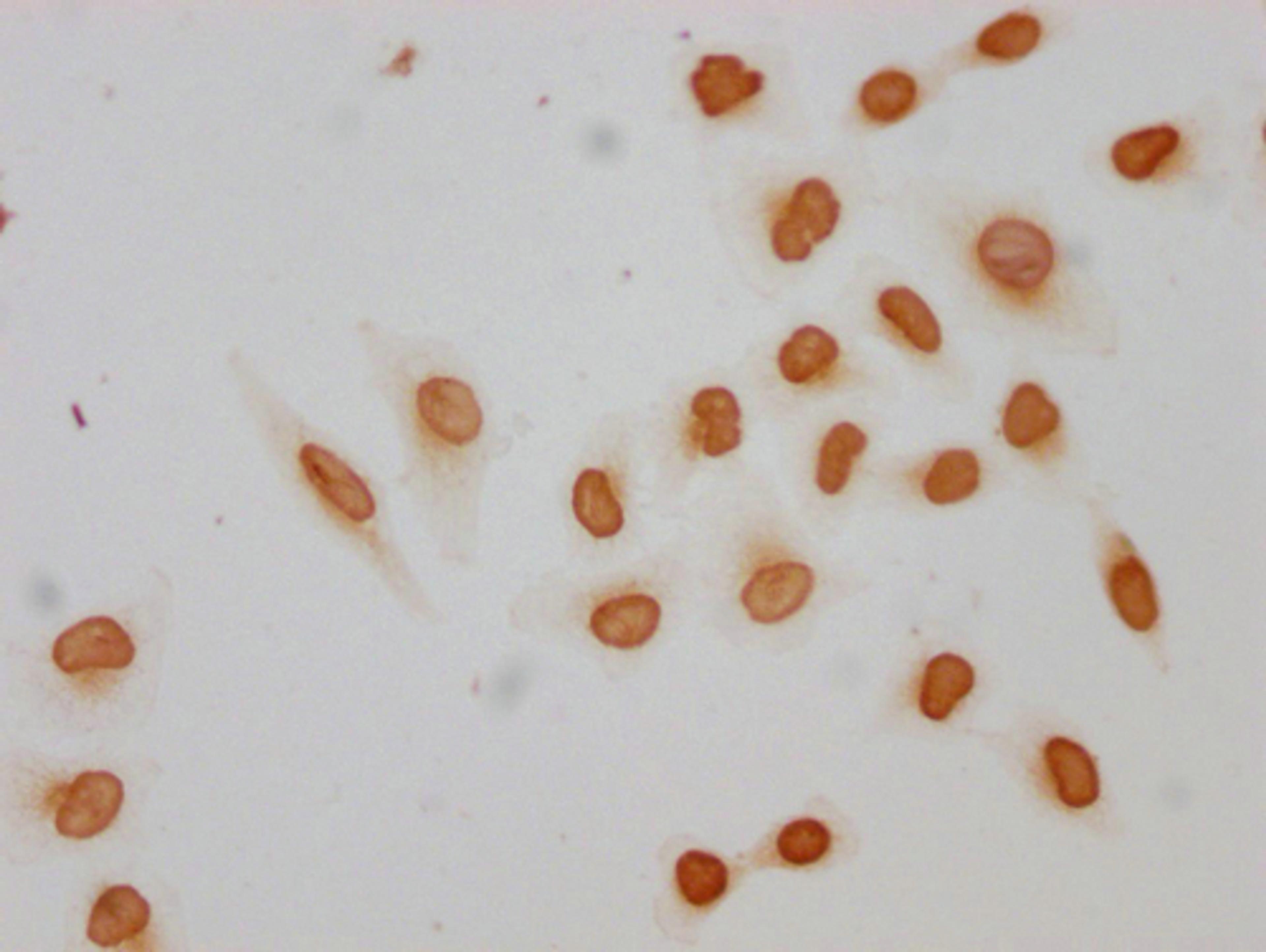 Immunocytochemistry analysis of CSB-PA010389PA09acHU diluted at 1:10 and staining in Hela cells(treated with 30mM sodium butyrate for 4h) performed on a Leica BondTM system. The cells were fixed in 4% formaldehyde, permeabilized using 0.2% Triton X-100 and blocked with 10% normal goat serum 30min at RT. Then primary antibody (1% BSA) was incubated at 4°C overnight. The primary is detected by a biotinylated secondary antibody and visualized using an HRP conjugated SP system.