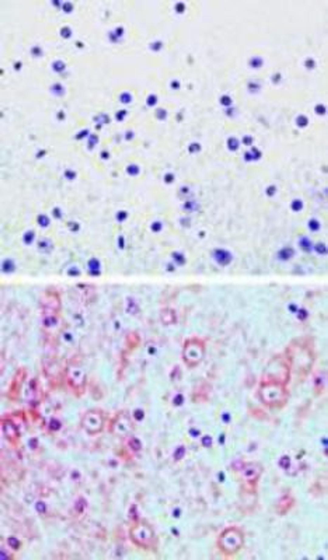 Immunohistochemistry-Paraffin: DMAP1 Antibody [NBP2-03982] - Analysis of DMAP1 in paraffin-embedded formalin-fixed mouse brain tissue using an isotype control (top) and this antibody (bottom) at 5 ug/ml.