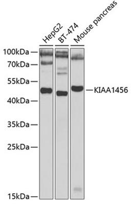 Western blot - KIAA1456 antibody (A7193)