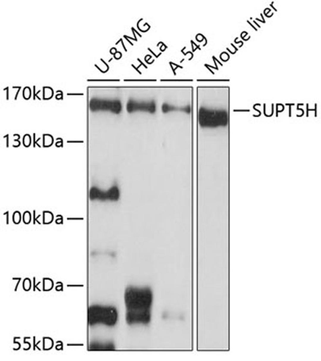 Western blot - SUPT5H antibody (A9193)