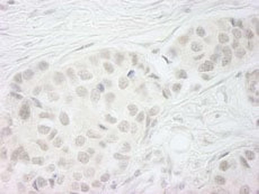 Detection of human BubR1 by immunohistochemistry.