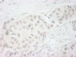 Detection of human BubR1 by immunohistochemistry.