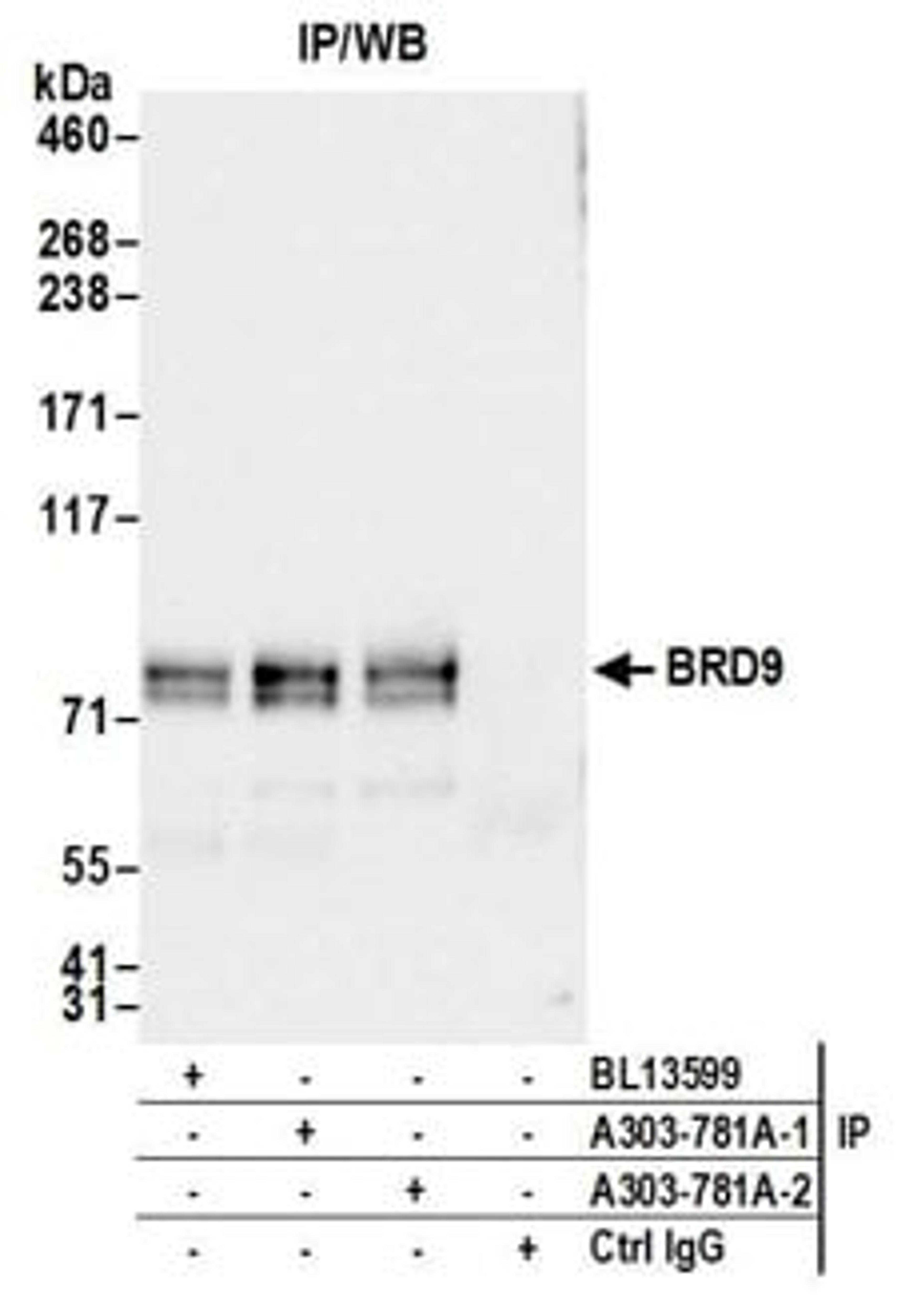 Detection of human BRD9 by western blot of immunoprecipitates.