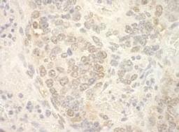 Detection of mouse NCBP2 by immunohistochemistry.