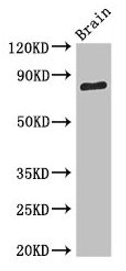 Western Blot. Positive WB detected in: Mouse brain tissue. All lanes: SV2B antibody at 3.4µg/ml. Secondary. Goat polyclonal to rabbit IgG at 1/50000 dilution. Predicted band size: 78, 61 kDa. Observed band size: 78 kDa