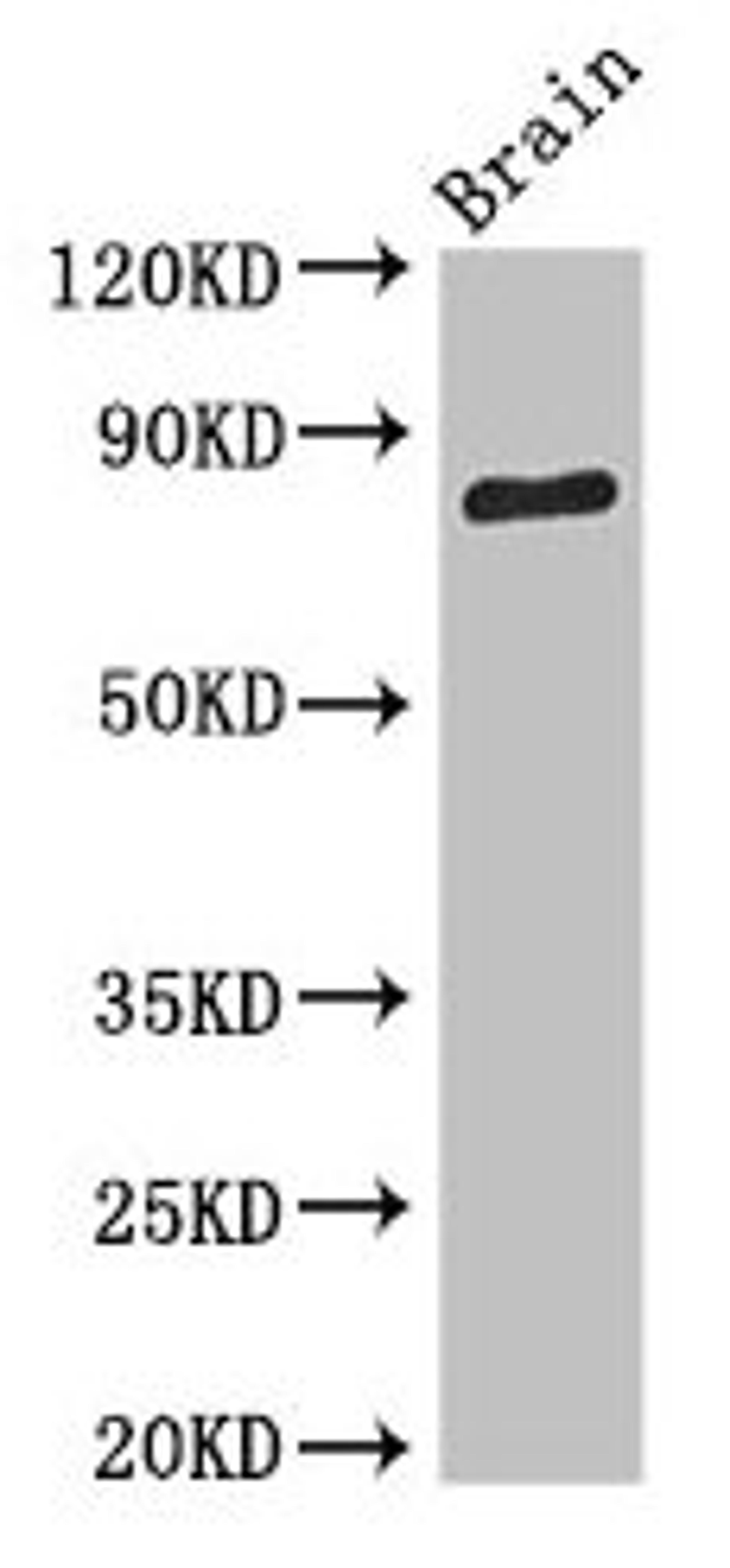 Western Blot. Positive WB detected in: Mouse brain tissue. All lanes: SV2B antibody at 3.4µg/ml. Secondary. Goat polyclonal to rabbit IgG at 1/50000 dilution. Predicted band size: 78, 61 kDa. Observed band size: 78 kDa