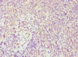 Immunohistochemistry of paraffin-embedded human tonsil tissue using CSB-PA008597ESR1HU at dilution of 1:100