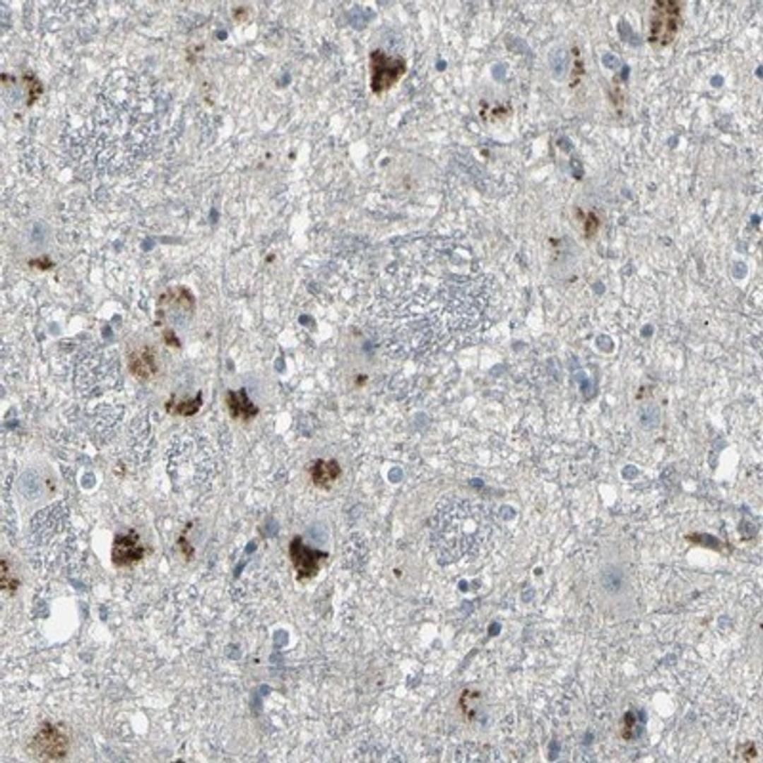 Immunohistochemistry-Paraffin: GPR19 Antibody [NBP1-87572] Staining of human hippocampus shows strong cytoplasmic positivity in neuronal cells.