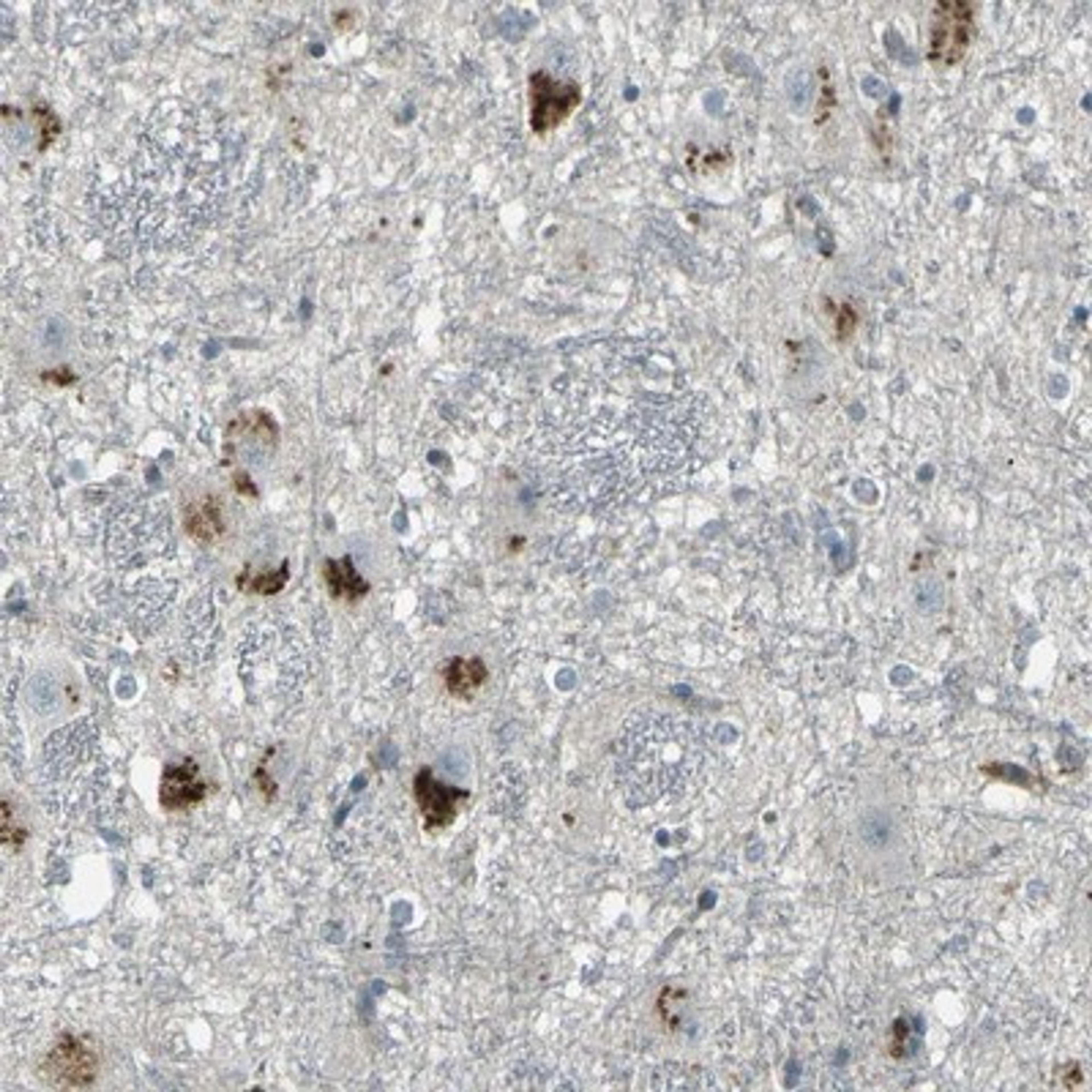 Immunohistochemistry-Paraffin: GPR19 Antibody [NBP1-87572] Staining of human hippocampus shows strong cytoplasmic positivity in neuronal cells.