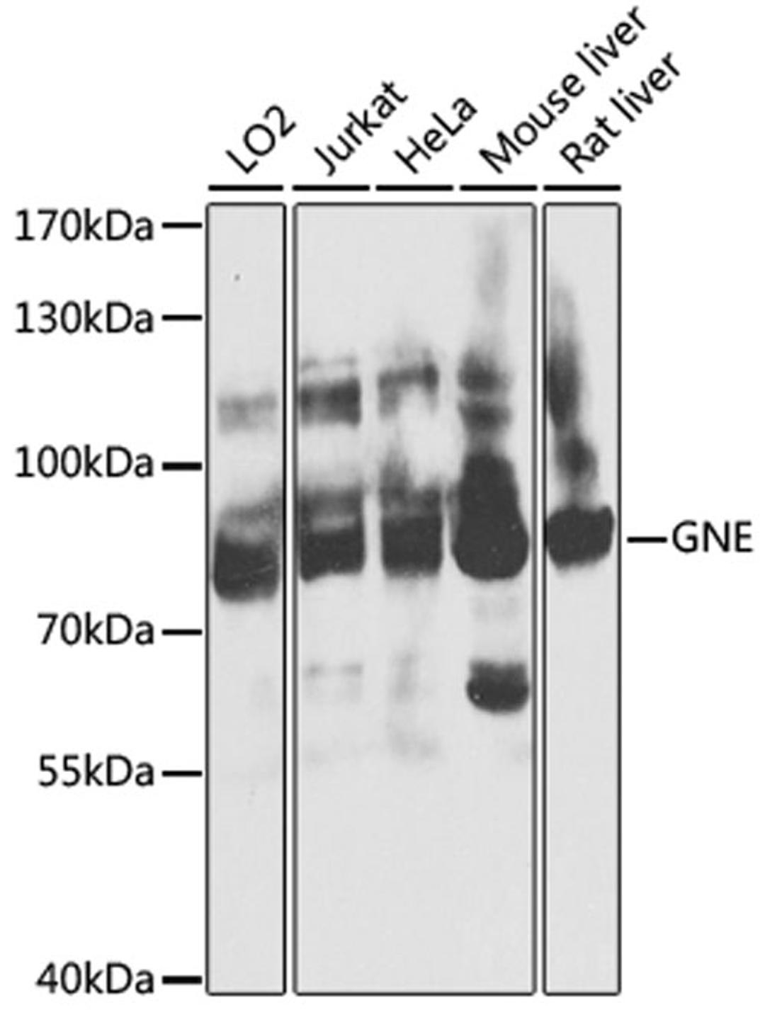 Western blot - GNE antibody (A8570)