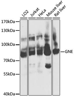 Western blot - GNE antibody (A8570)