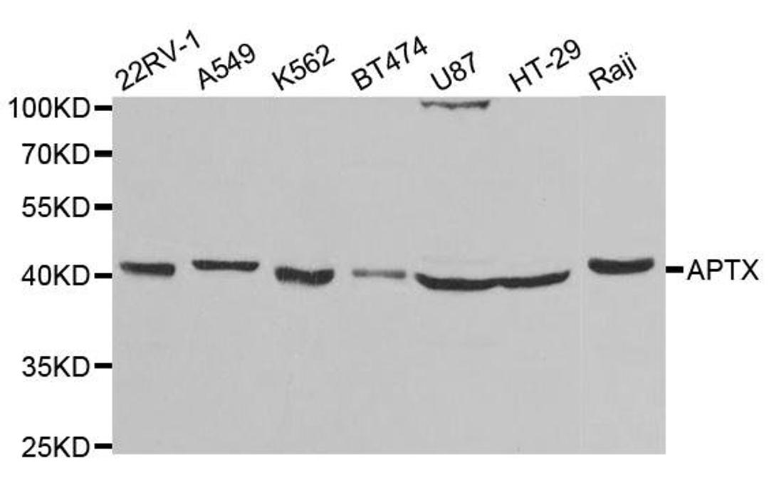 Western blot analysis of extracts of various cell lines using APTX antibody