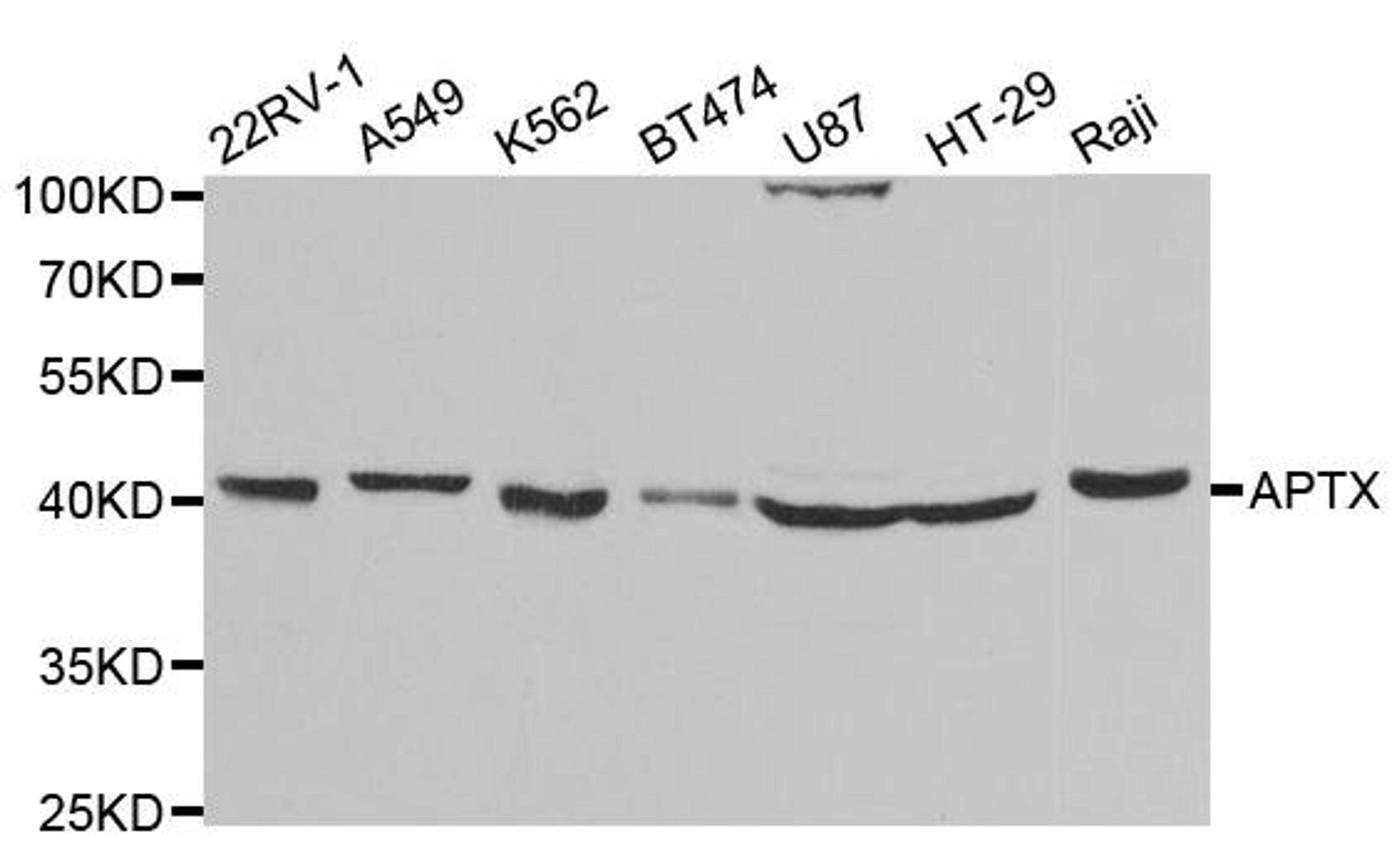 Western blot analysis of extracts of various cell lines using APTX antibody