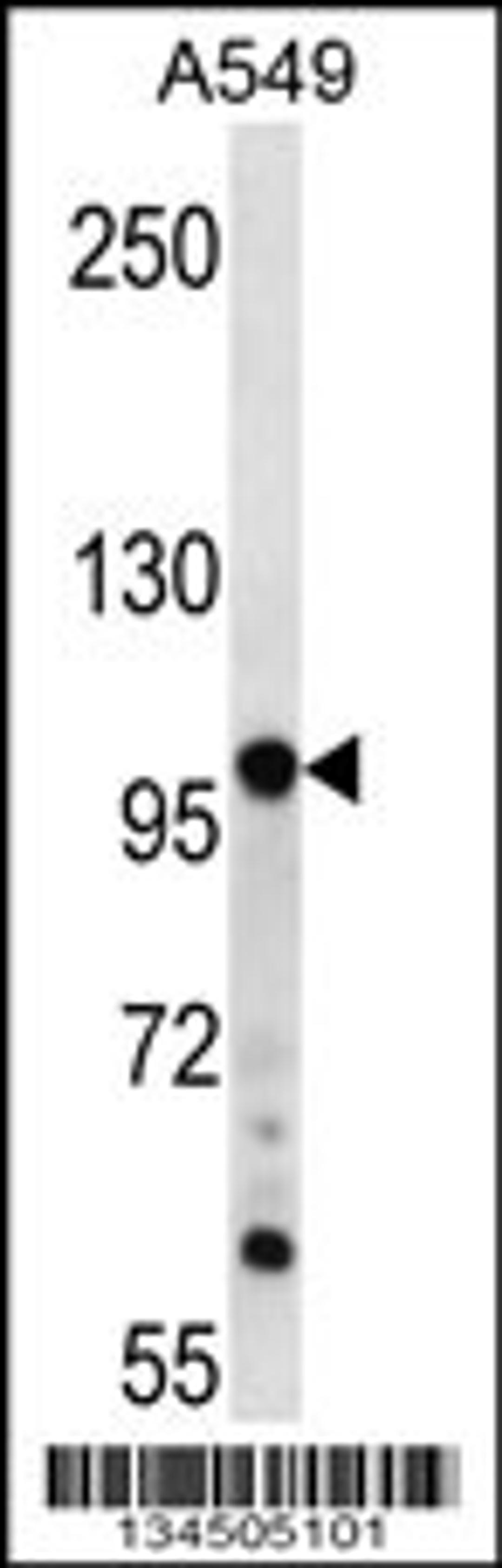 Western blot analysis in A549 cell line lysates (35ug/lane).