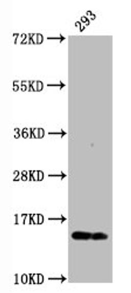 Western Blot. Positive WB detected in:293 whole cell lysate. All lanes:Phospho-Histone H2AX (S139) antibody at 0.23μg/ml. Secondary. Goat polyclonal to rabbit IgG at 1/50000 dilution. Predicted band size: 15 KDa. Observed band size: 15 KDa