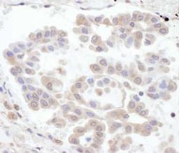 Detection of human RABGEF1 by immunohistochemistry.