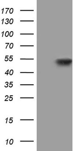 Western Blot: NIPP1 Antibody (4E5) [NBP2-45386] - Analysis of HEK293T cells were transfected with the pCMV6-ENTRY control (Left lane) or pCMV6-ENTRY NIPP1.