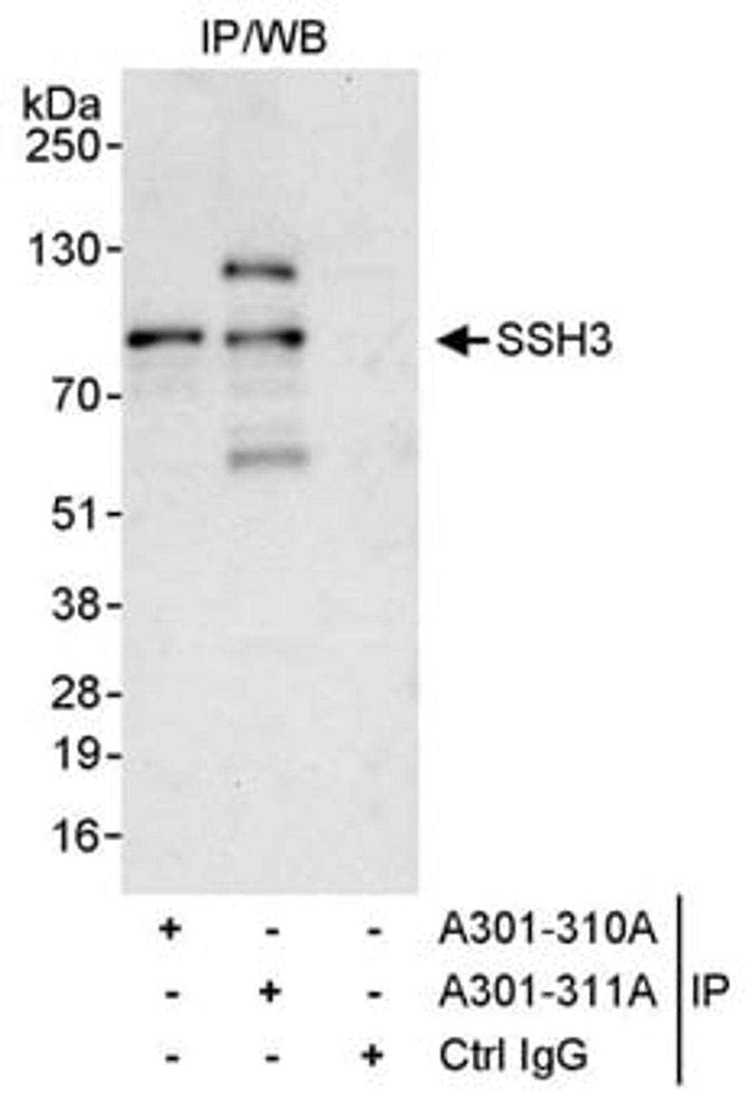 Detection of human SSH3 by western blot of immunoprecipitates.