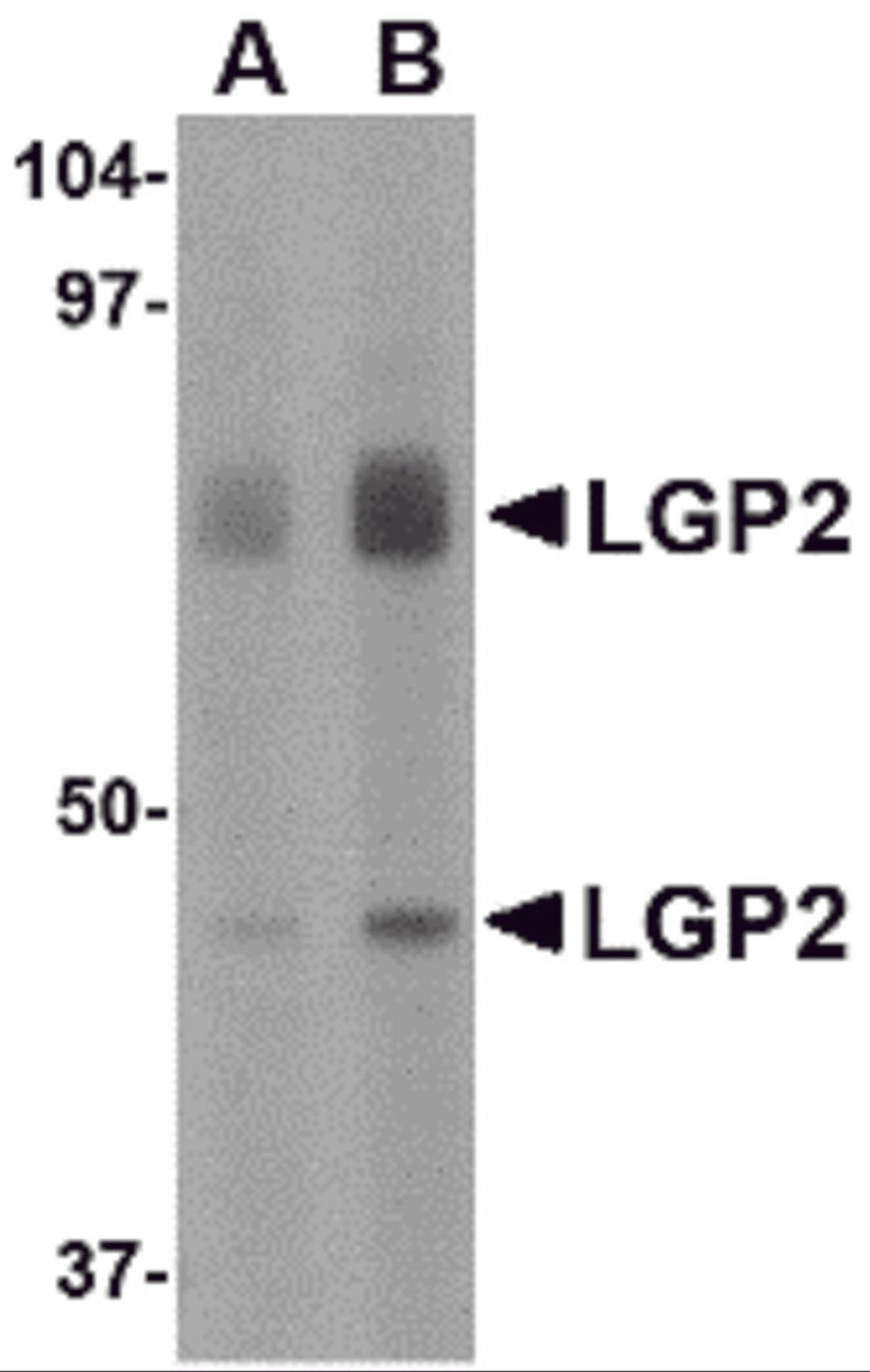 Western blot analysis of LGP2 in rat kidney tissue lysate with LGP2 antibody at (A) 1 and (B) 2 &#956;g/mL.