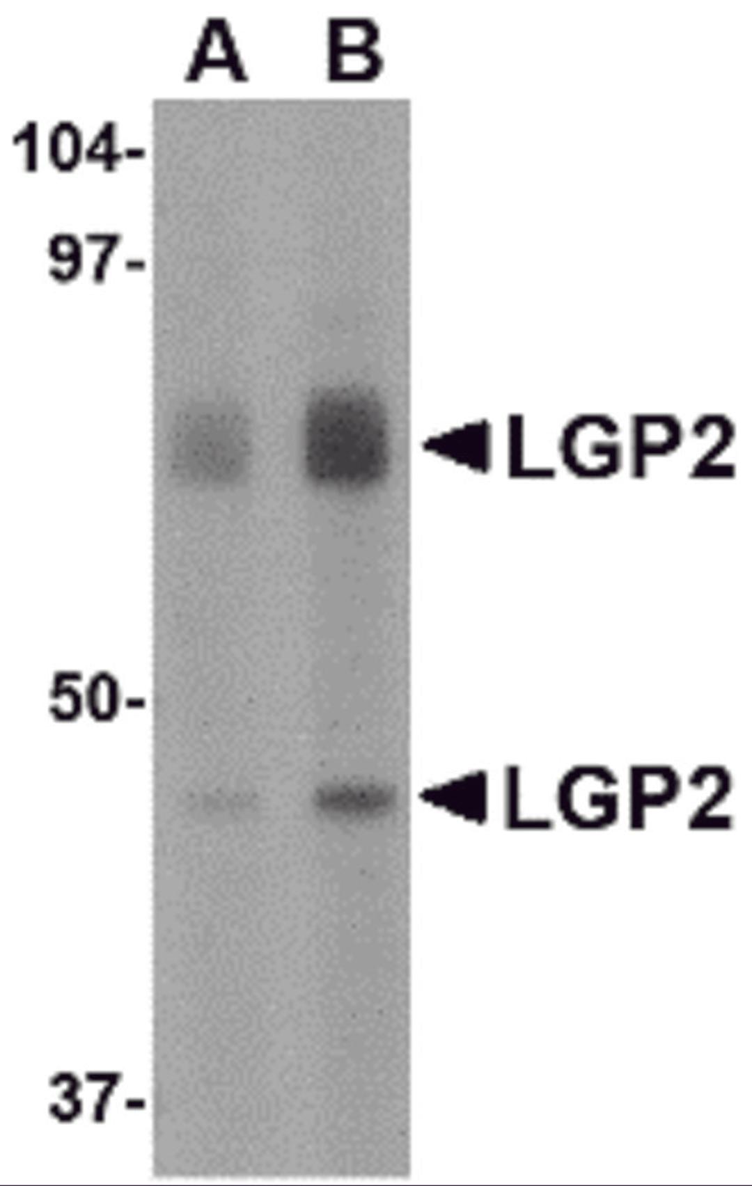 Western blot analysis of LGP2 in rat kidney tissue lysate with LGP2 antibody at (A) 1 and (B) 2 μg/mL.