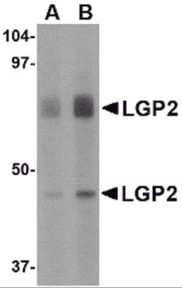 Western blot analysis of LGP2 in rat kidney tissue lysate with LGP2 antibody at (A) 1 and (B) 2 μg/mL.