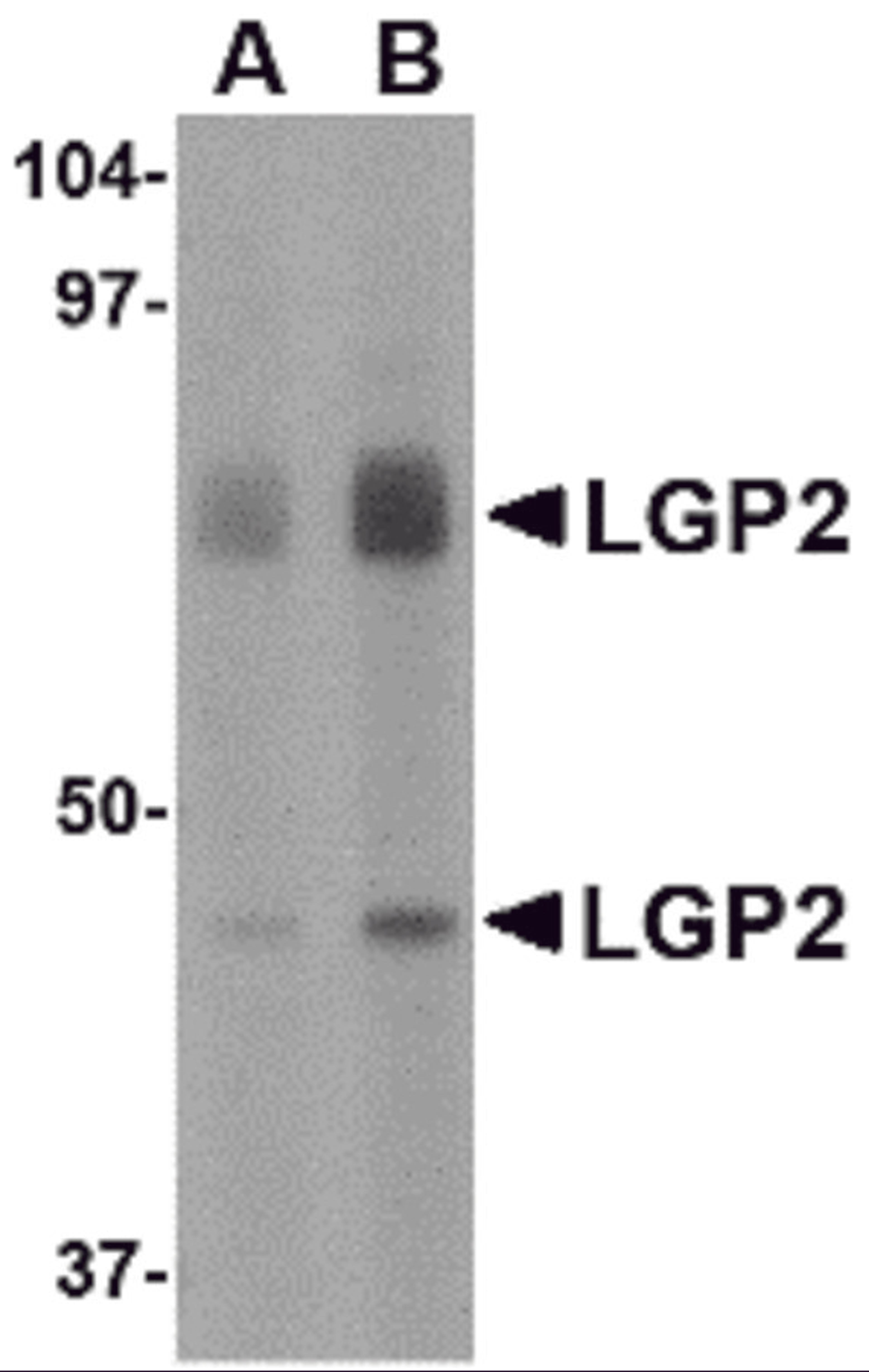 Western blot analysis of LGP2 in rat kidney tissue lysate with LGP2 antibody at (A) 1 and (B) 2 μg/mL.