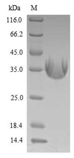 (Tris-Glycine gel) Discontinuous SDS-PAGE (reduced) with 5% enrichment gel and 15% separation gel.