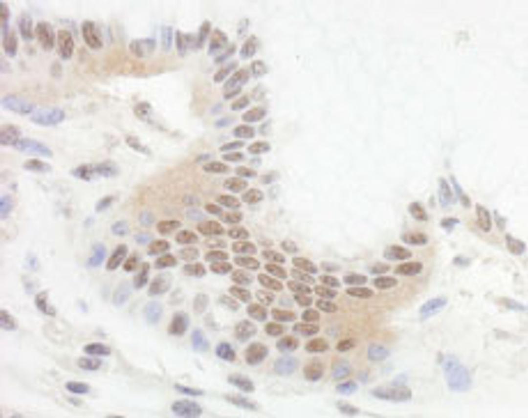 Detection of human Bcl11b by immunohistochemistry.