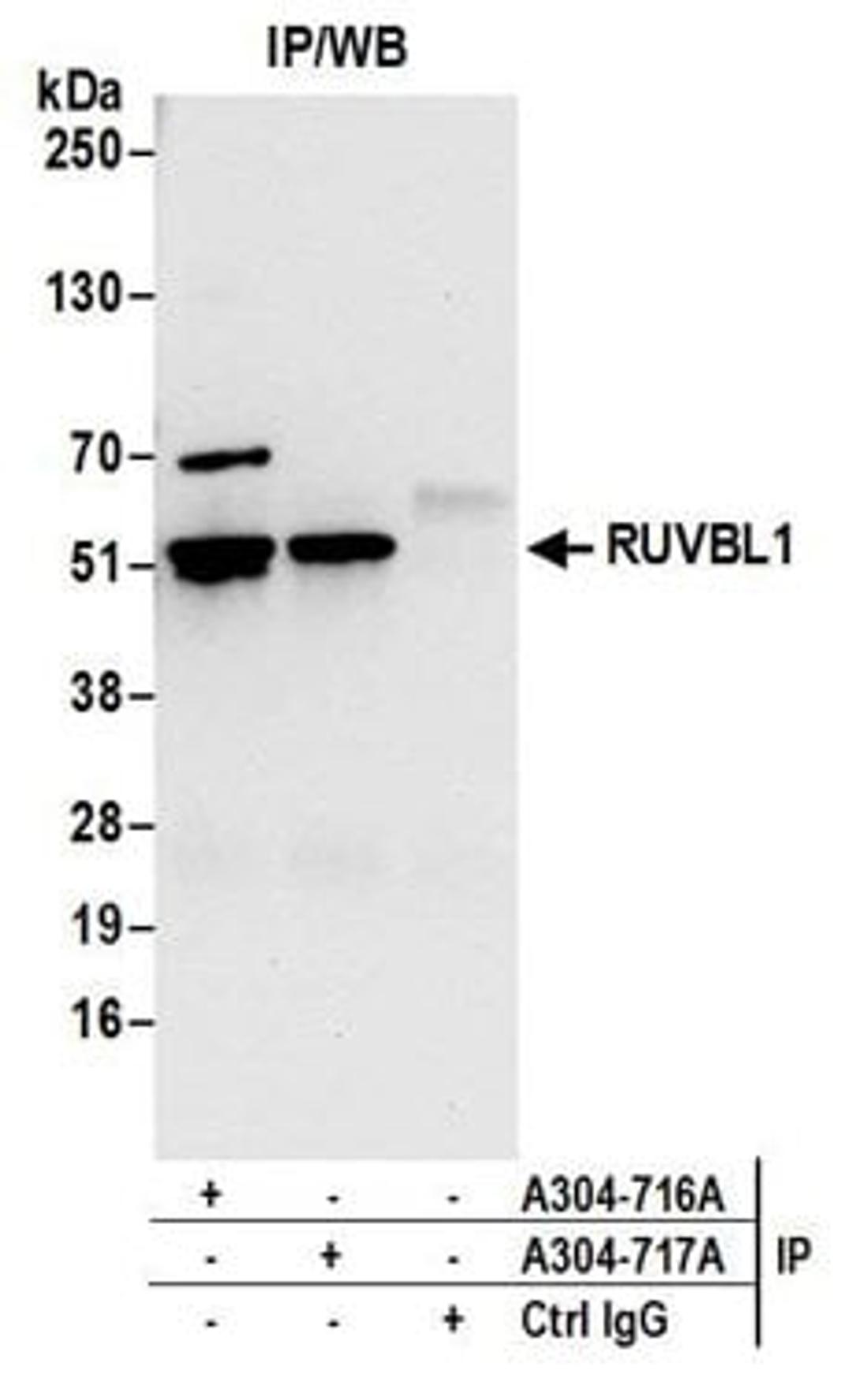 Detection of human RUVBL1 by western blot of immunoprecipitates.