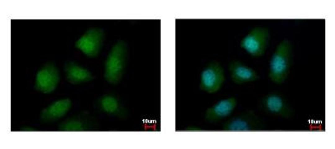 Immunocytochemistry/Immunofluorescence: PELO Antibody [NBP2-19769] - Sample: A431 cells were fixed in 4% paraformaldehyde at RT for 15 min. Green: PELO protein stained by PELO antibody diluted at 1:500. Blue: Hoechst 33342 staining.