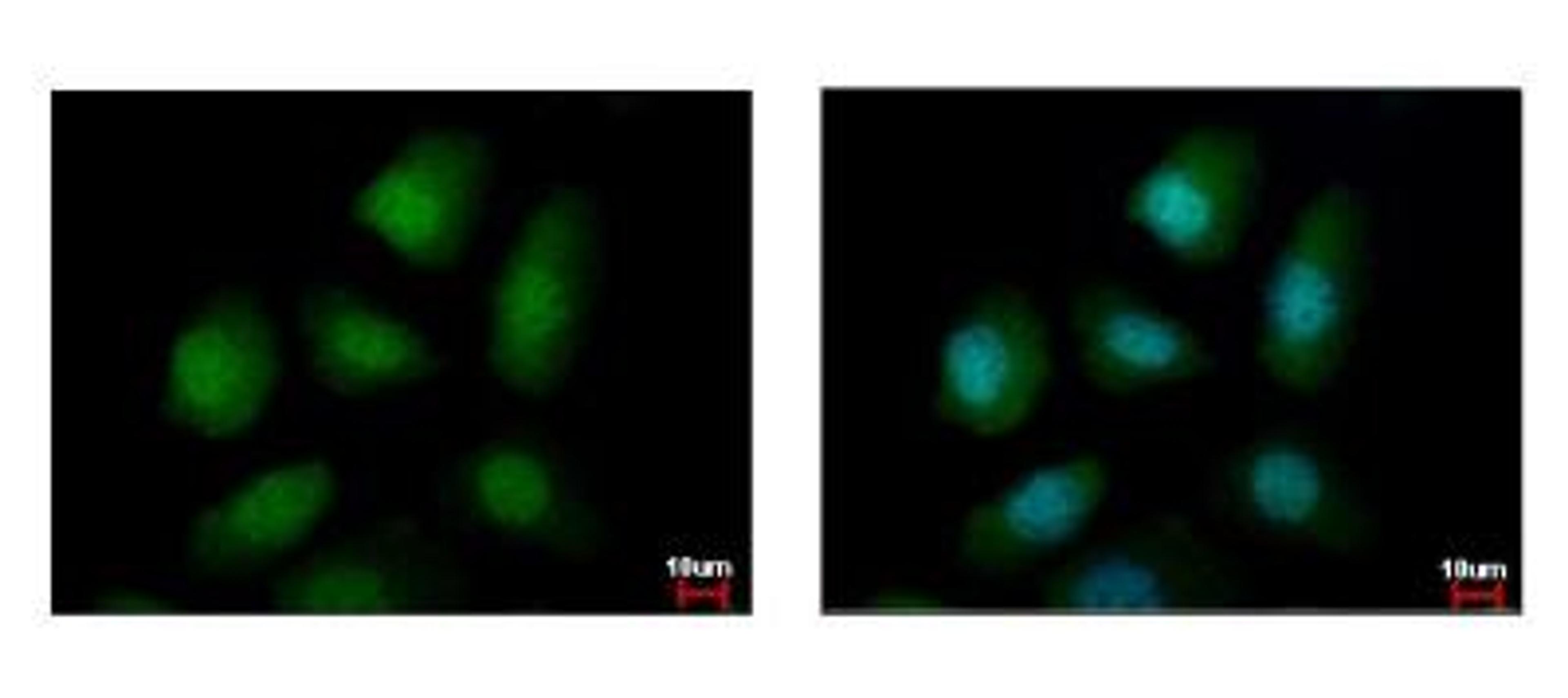 Immunocytochemistry/Immunofluorescence: PELO Antibody [NBP2-19769] - Sample: A431 cells were fixed in 4% paraformaldehyde at RT for 15 min. Green: PELO protein stained by PELO antibody diluted at 1:500. Blue: Hoechst 33342 staining.