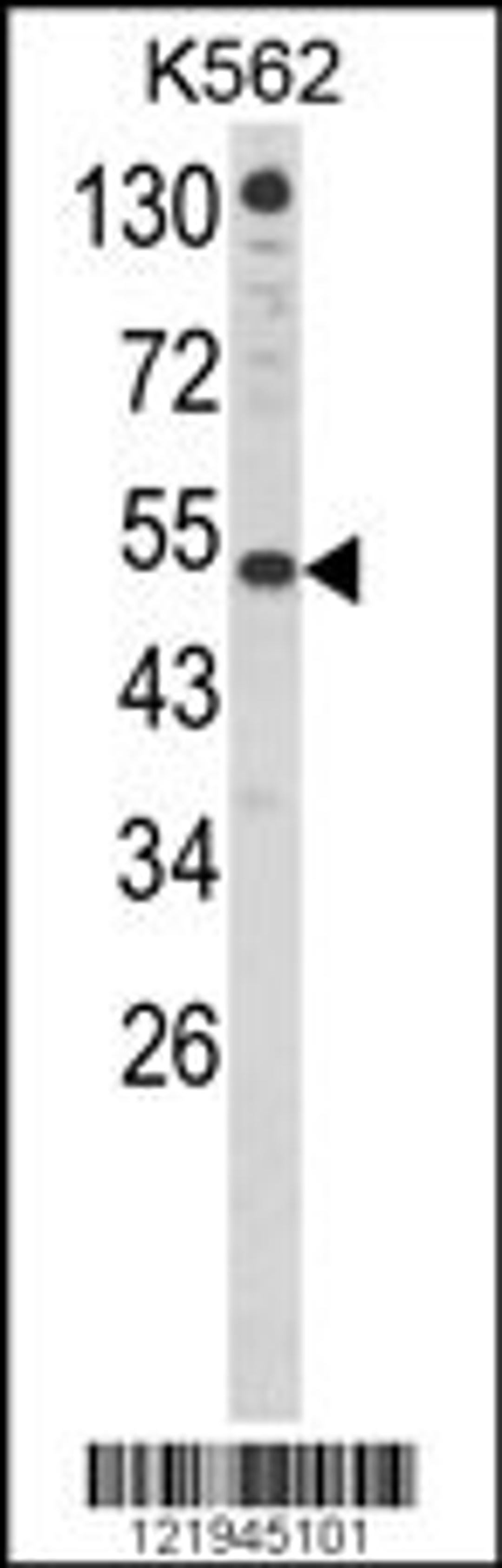 Western blot analysis of IFNAR1 Antibody in K562 cell line lysates (35ug/lane)(8ug/ml)