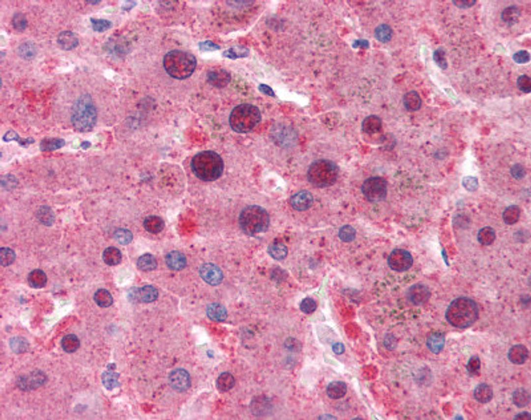 Immunohistochemistry staining of MYC in liver tissue using MYC monoclonal Antibody.