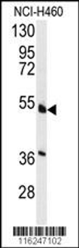 Western blot analysis of anti-HNF4A Antibody (S142) in NCI-H460 cell line lysates (35ug/lane)