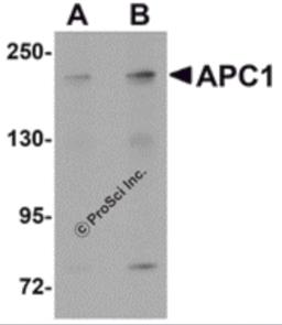 Western blot analysis of APC1 in SK-N-SH cell lysate with APC1 antibody at (A) 1 and (B) 2 &#956;g/mL.