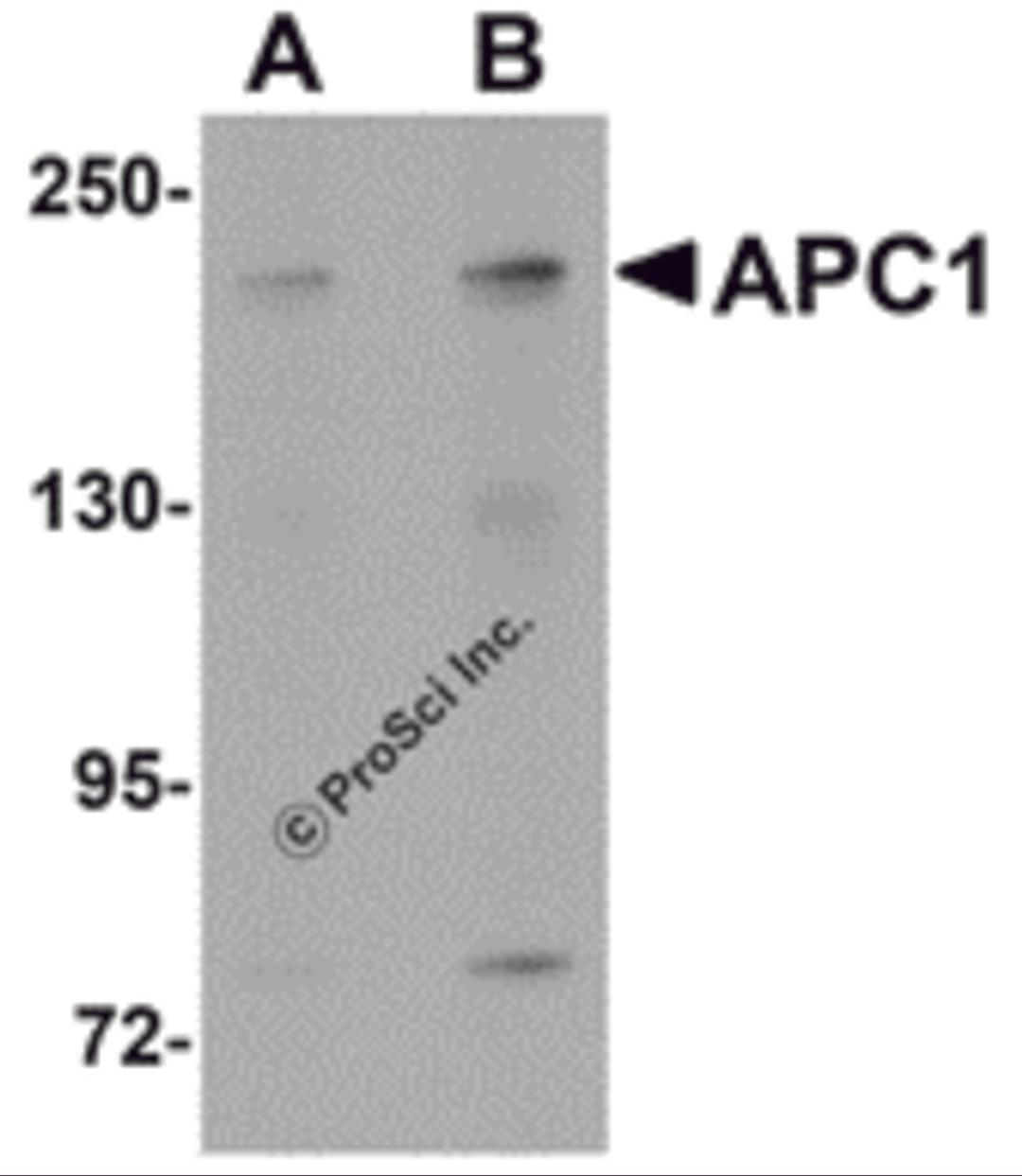 Western blot analysis of APC1 in SK-N-SH cell lysate with APC1 antibody at (A) 1 and (B) 2 μg/mL.