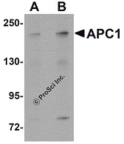 Western blot analysis of APC1 in SK-N-SH cell lysate with APC1 antibody at (A) 1 and (B) 2 μg/mL.