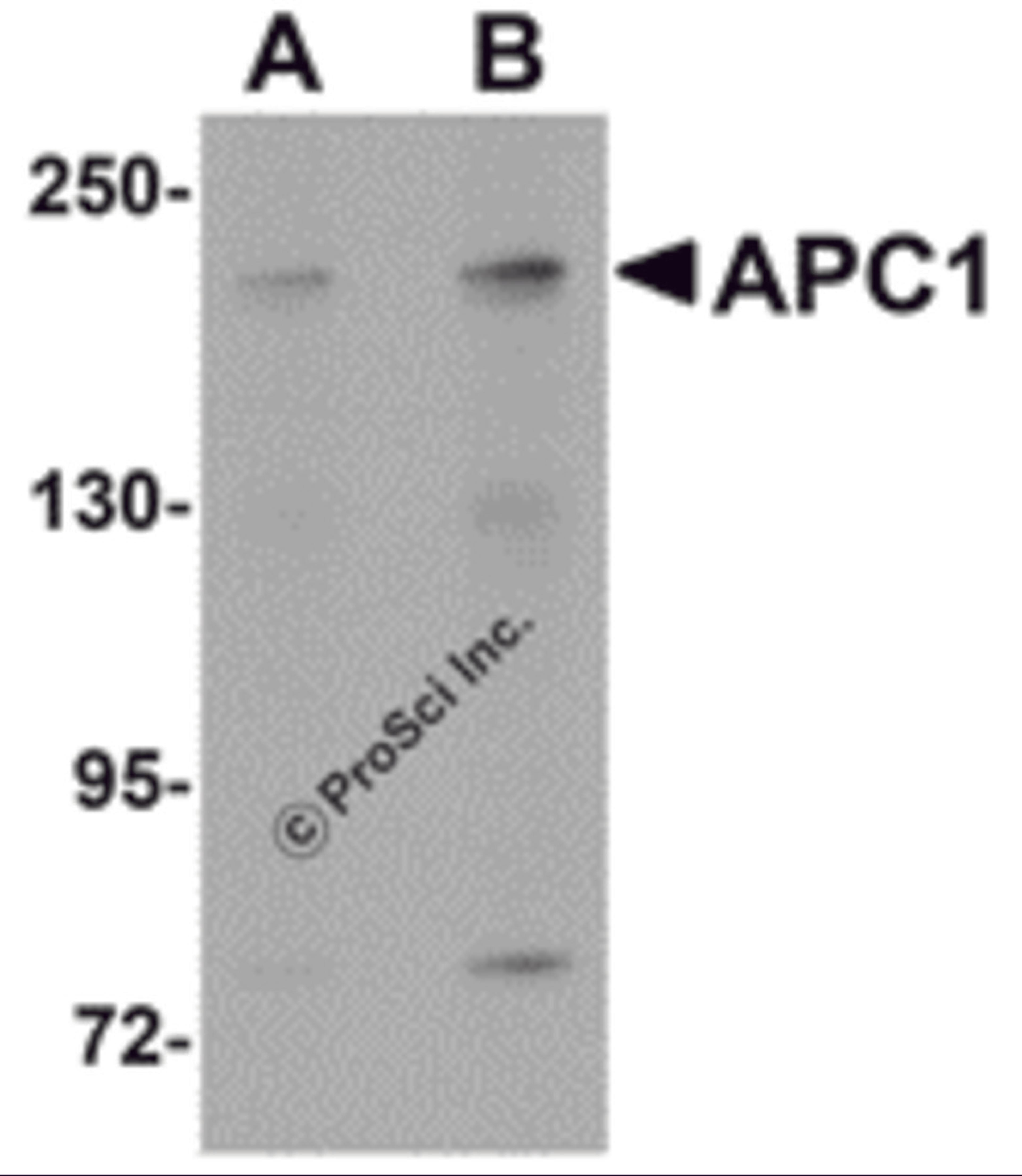 Western blot analysis of APC1 in SK-N-SH cell lysate with APC1 antibody at (A) 1 and (B) 2 μg/mL.