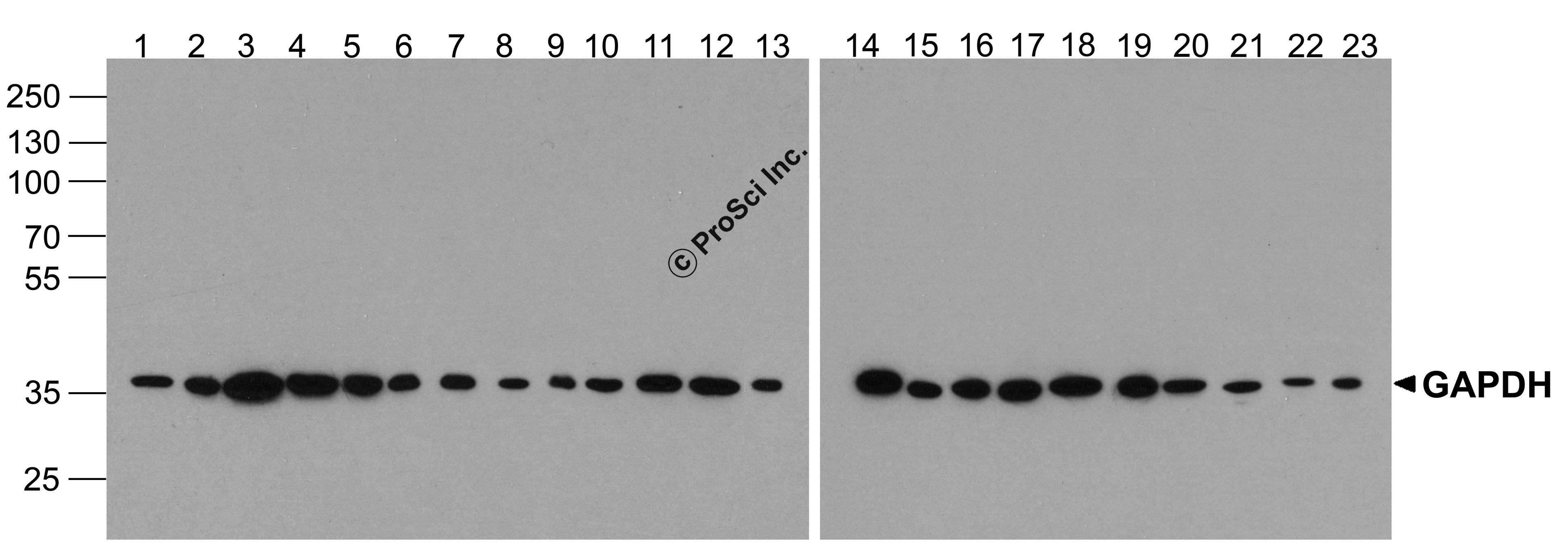 Western blot analysis of GAPDH in multiple cell and tissue lysates with GAPDH antibody at 1 μg/ml. Lanes 1-23, 293, A431, A549, Daudi, HeLa, HepG2, Jurkat, K562, MOLT, 3T3, Raji, Ramos, U937, human brain, mouse brain, rat brain, rabbit brain, human h