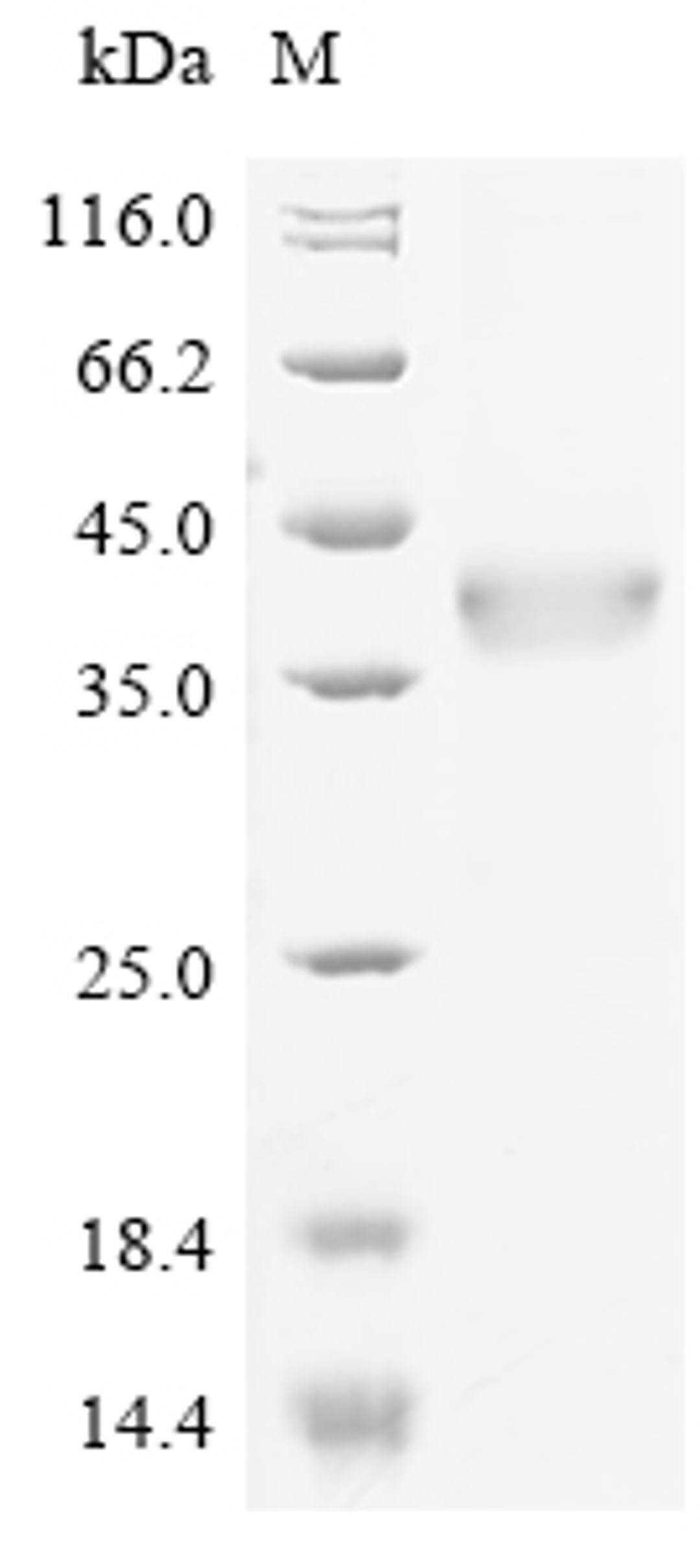 (Tris-Glycine gel) Discontinuous SDS-PAGE (reduced) with 5% enrichment gel and 15% separation gel.