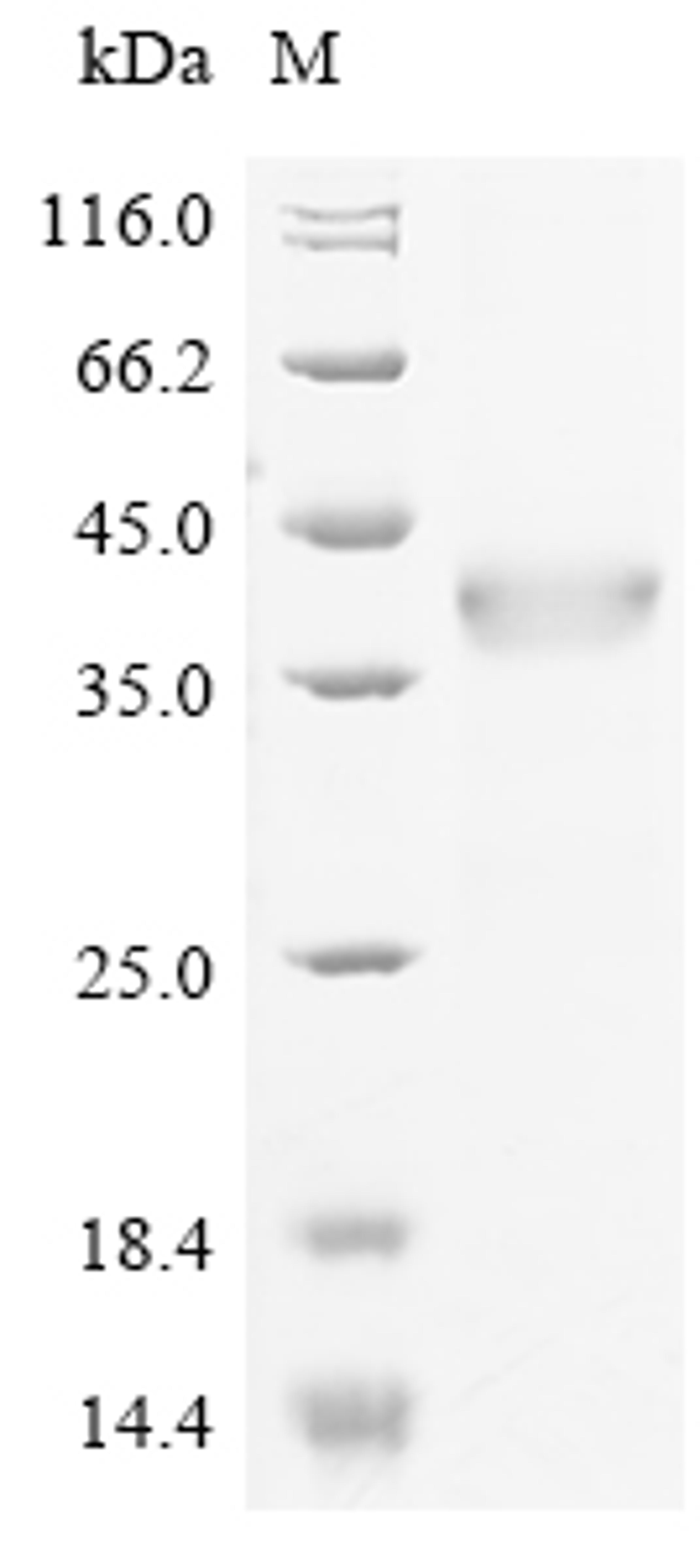 (Tris-Glycine gel) Discontinuous SDS-PAGE (reduced) with 5% enrichment gel and 15% separation gel.