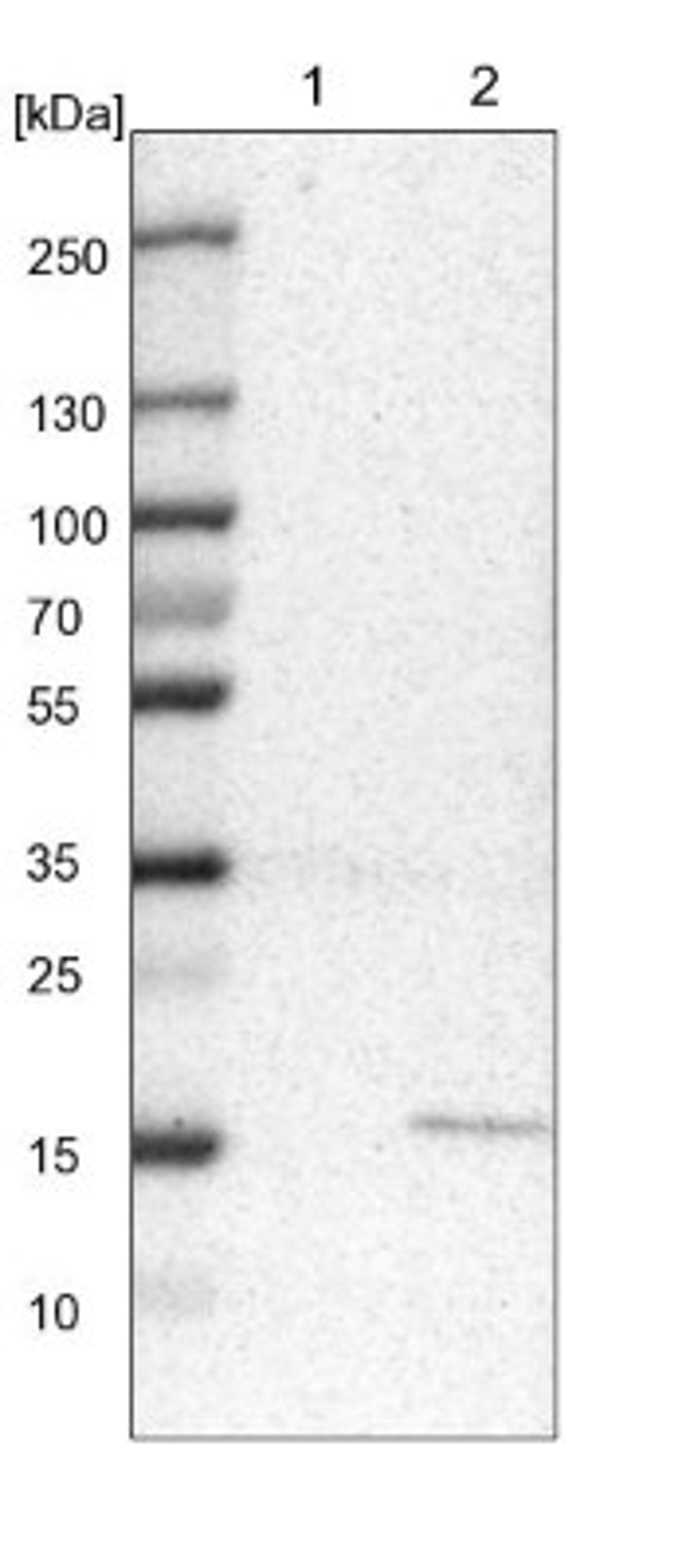 Western Blot: MRPS24 Antibody [NBP1-92140] - Lane 1: NIH-3T3 cell lysate (Mouse embryonic fibroblast cells)<br/>Lane 2: NBT-II cell lysate (Rat Wistar bladder tumour cells)