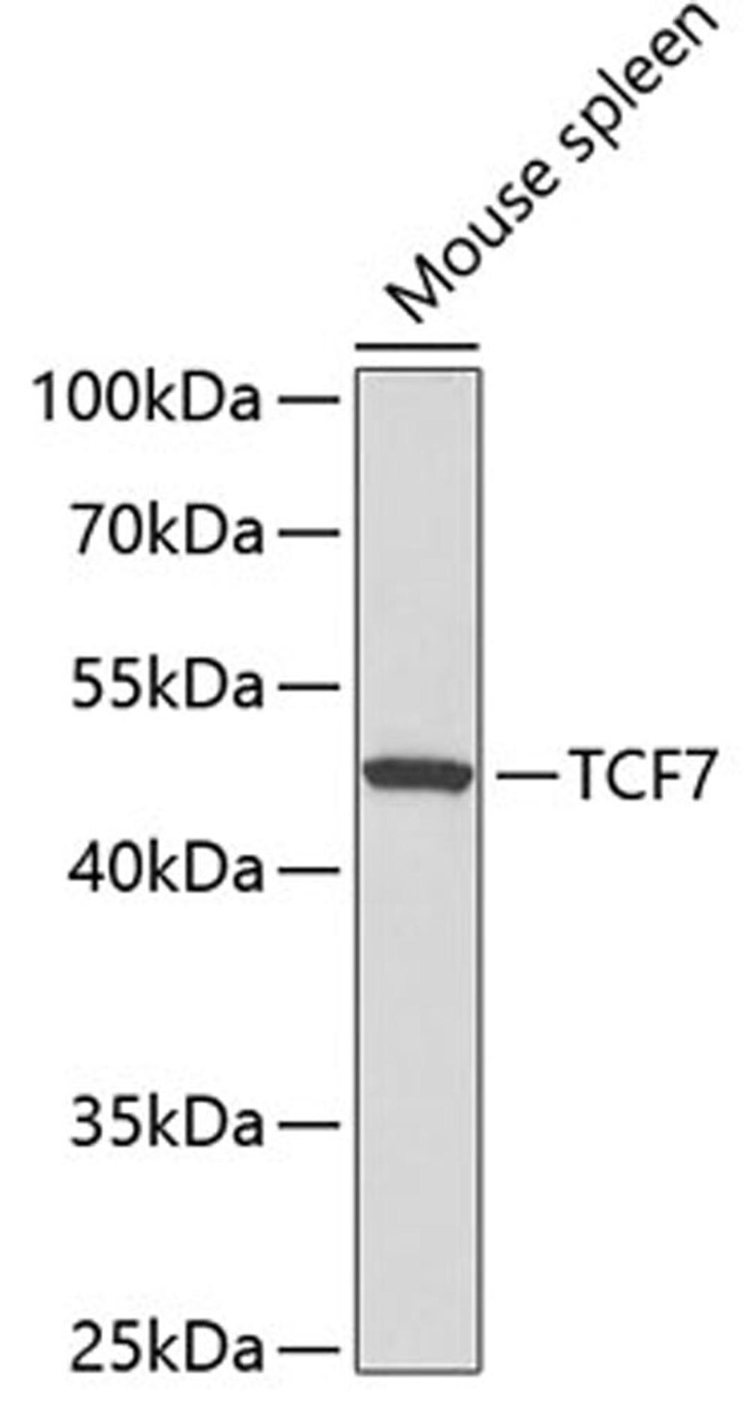 Western blot - TCF7 antibody (A3091)