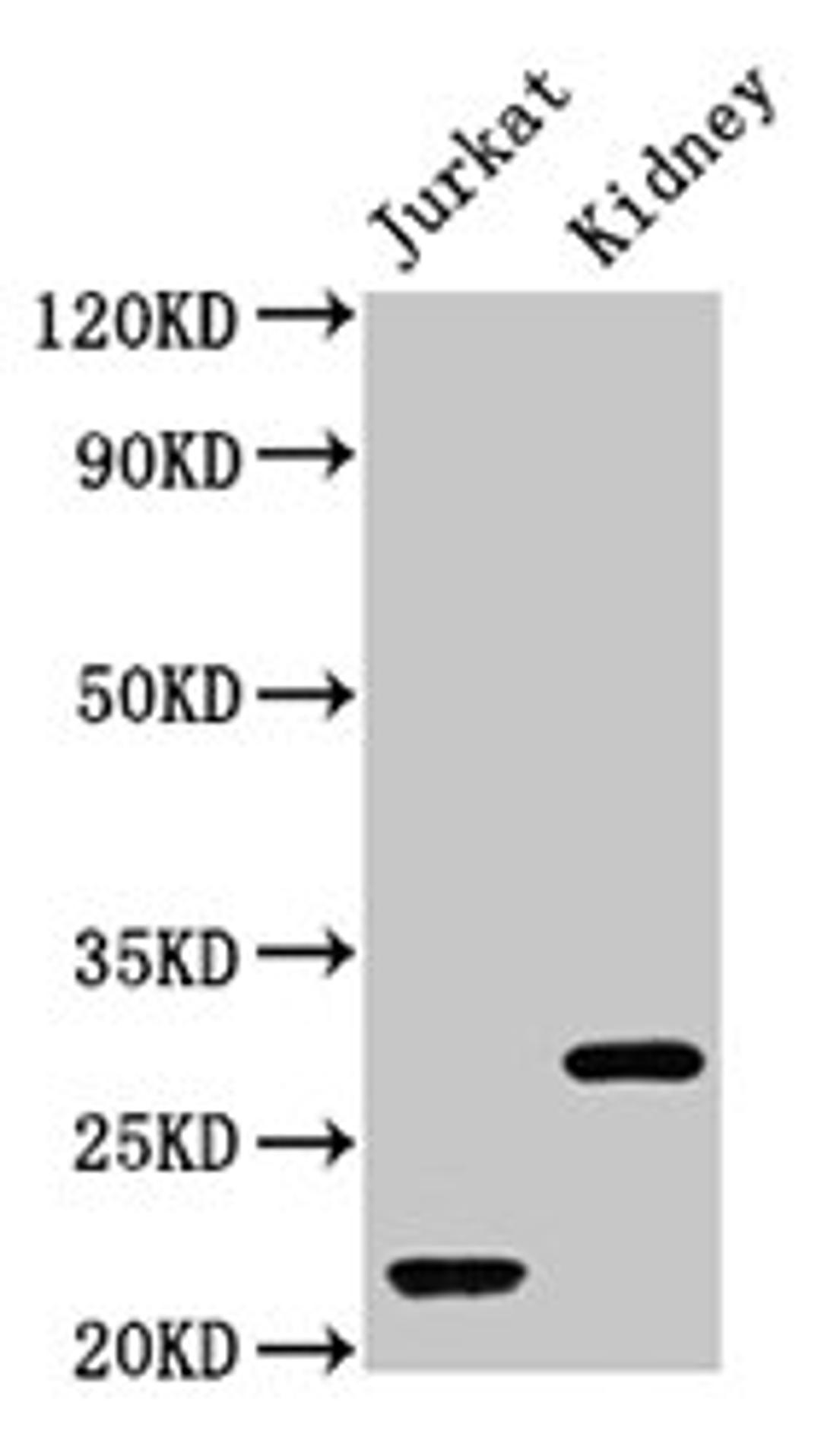 Western Blot. Positive WB detected in: Jurkat whole cell lysate, Rat kidney tissue. All lanes: HIST1H1C antibody at 1µg/ml. Secondary. Goat polyclonal to rabbit IgG at 1/50000 dilution. Predicted band size: 22 kDa. Observed band size: 22, 28 kDa