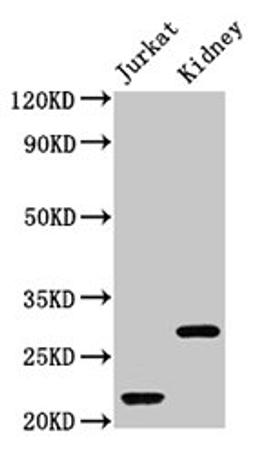 Western Blot. Positive WB detected in: Jurkat whole cell lysate, Rat kidney tissue. All lanes: HIST1H1C antibody at 1µg/ml. Secondary. Goat polyclonal to rabbit IgG at 1/50000 dilution. Predicted band size: 22 kDa. Observed band size: 22, 28 kDa